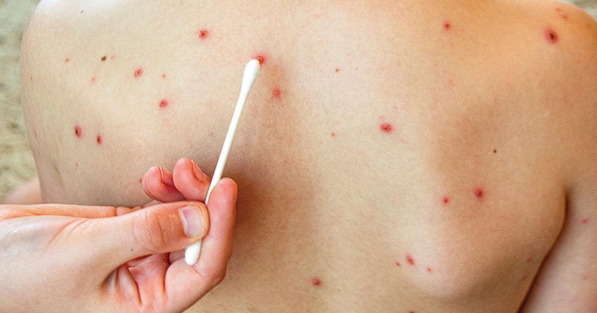 Nyolc megbetegedés Hargita megyében